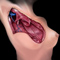 thumbnail of medical illustration